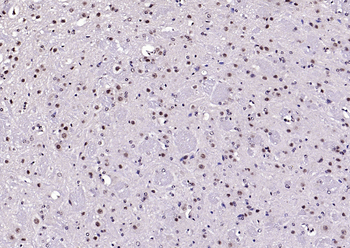 Neuro D Rabbit Polyclonal Antibody