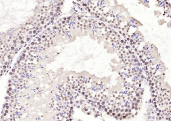 Neuro D Rabbit Polyclonal Antibody