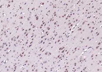 Neuro D Rabbit Polyclonal Antibody