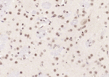 Neuro D Rabbit Polyclonal Antibody