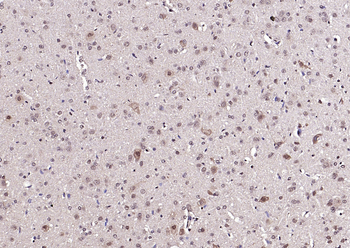 Neuro D Rabbit Polyclonal Antibody