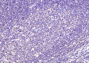 Phospho-NFATC4 (Ser168 + Ser170) Rabbit Polyclonal Antibody