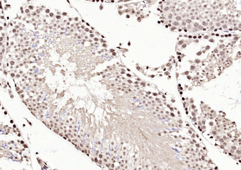 Phospho-NFATC4 (Ser168 + Ser170) Rabbit Polyclonal Antibody