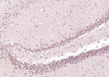 NFIA Rabbit Polyclonal Antibody