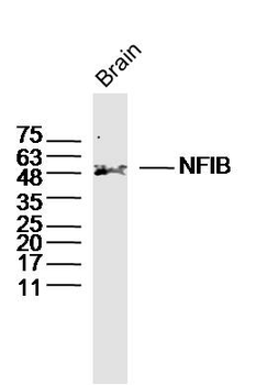 NFIB Rabbit Polyclonal Antibody