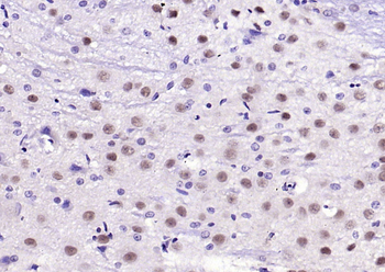 Nova1 Rabbit Polyclonal Antibody