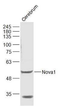 Nova1 Rabbit Polyclonal Antibody