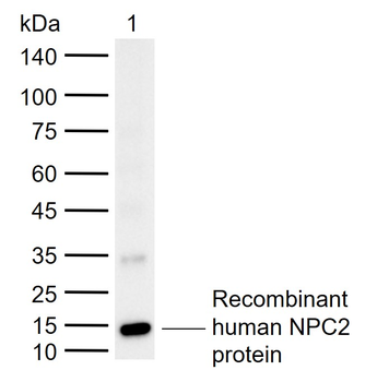 NPC2 Rabbit Polyclonal Antibody