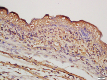 NR5A2 Rabbit Polyclonal Antibody