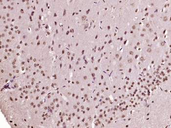 OAS2 Rabbit Polyclonal Antibody