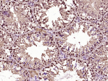 OAS2 Rabbit Polyclonal Antibody