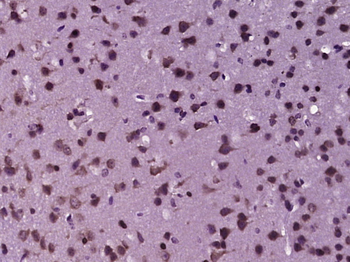 OAS3 Rabbit Polyclonal Antibody