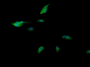 OLIG2 Rabbit Polyclonal Antibody