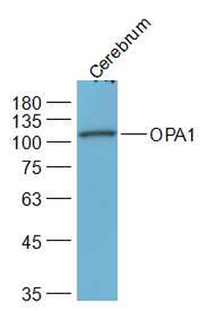 OPA1 Rabbit Polyclonal Antibody