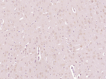 ARPC5 Rabbit Polyclonal Antibody