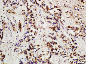 CDKN1A/P21 Rabbit Polyclonal Antibody