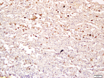CDKN1A/P21 Rabbit Polyclonal Antibody