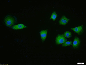 CDKN1A/P21 Rabbit Polyclonal Antibody