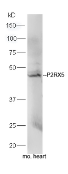 P2RX5 Rabbit Polyclonal Antibody