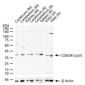CDK5R1/p35 Rabbit Polyclonal Antibody