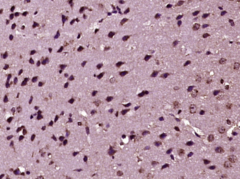 CDK5R1/p35 Rabbit Polyclonal Antibody