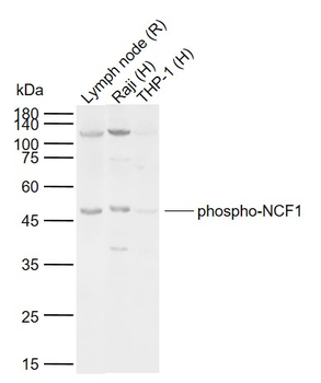 Phospho-NCF1 (Ser359) Rabbit Polyclonal Antibody