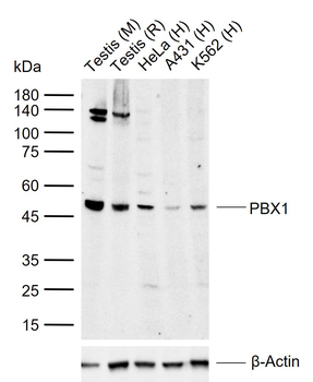 PBX1 Rabbit Polyclonal Antibody