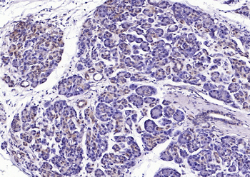 PCYT1A Rabbit Polyclonal Antibody