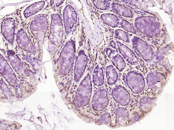 PCYT1A Rabbit Polyclonal Antibody