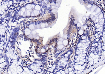 PCYT1A Rabbit Polyclonal Antibody