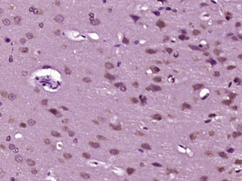 Phospho-PKC Epsilon (Ser729) Rabbit Polyclonal Antibody