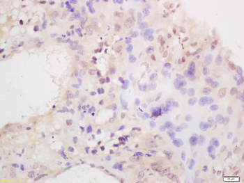 Placental lactogen I+II Rabbit Polyclonal Antibody