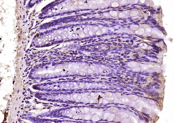 PLAGL1 Rabbit Polyclonal Antibody