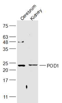 POD1 Rabbit Polyclonal Antibody