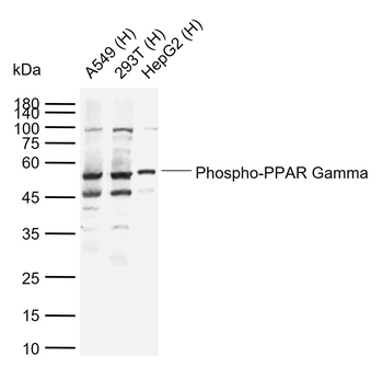 Phospho-PPAR Gamma (ser273) Rabbit Polyclonal Antibody