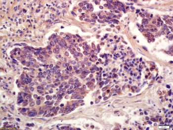 Phospho-PPAR Gamma (ser273) Rabbit Polyclonal Antibody