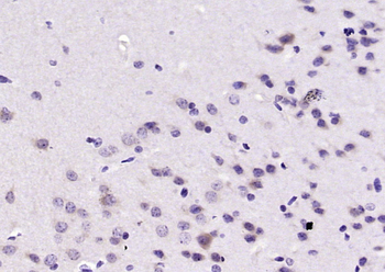 PPP2R2B/PP2A-B55 Rabbit Polyclonal Antibody