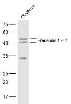 Presenilin 1 + 2 Rabbit Polyclonal Antibody