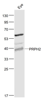 PRPH2 Rabbit Polyclonal Antibody