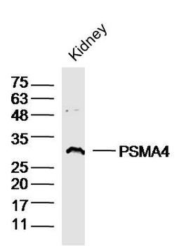PSMA4 Rabbit Polyclonal Antibody