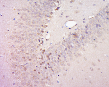 PSMA4 Rabbit Polyclonal Antibody