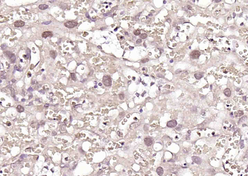 PTBP1 Rabbit Polyclonal Antibody