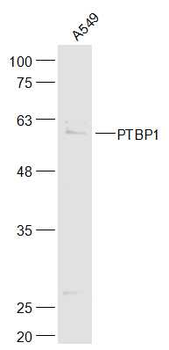 PTBP1 Rabbit Polyclonal Antibody