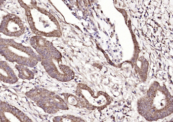 PTOV1 Rabbit Polyclonal Antibody