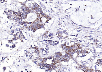 PTOV1 Rabbit Polyclonal Antibody