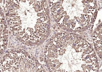 PTOV1 Rabbit Polyclonal Antibody