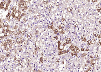 PTOV1 Rabbit Polyclonal Antibody