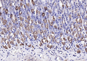 PTOV1 Rabbit Polyclonal Antibody