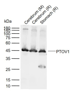 PTOV1 Rabbit Polyclonal Antibody
