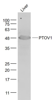 PTOV1 Rabbit Polyclonal Antibody